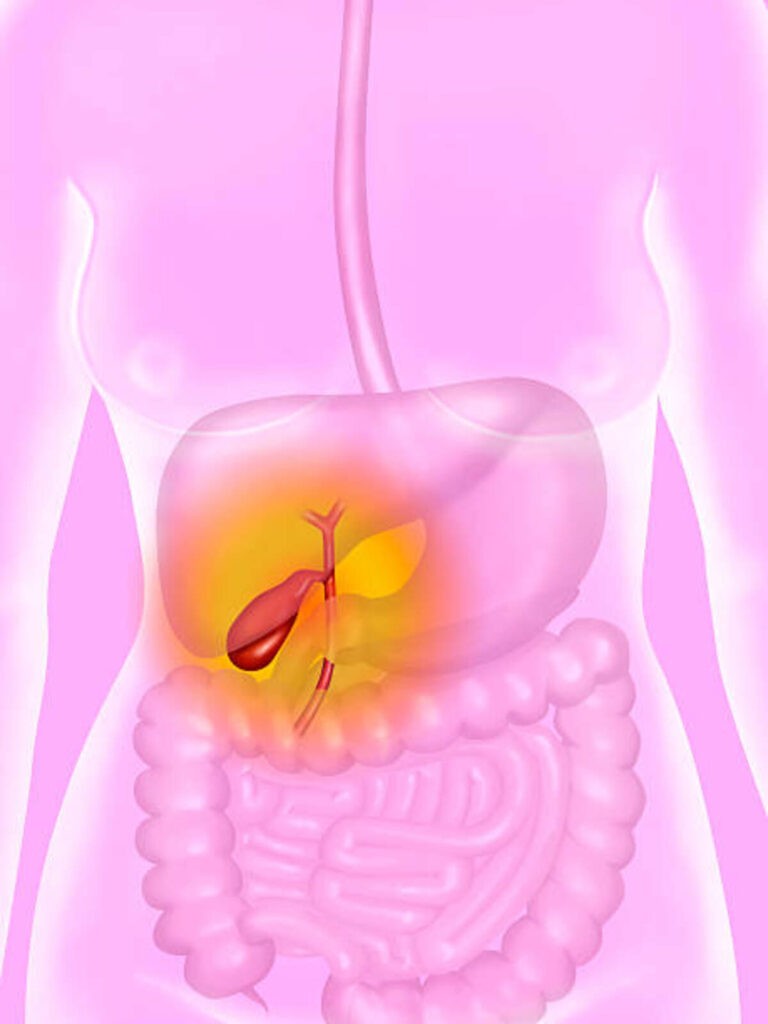 gallbladder-pain-what-are-the-symptoms-of-gallbladder-trouble